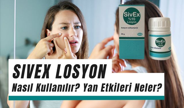 Sivex Losyon Nasıl Kullanılır? Sivilceleri Geçirir Mi?