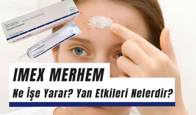 IMEX Merhem Ne İşe Yarar? Sivilceye İyi Gelir Mi?